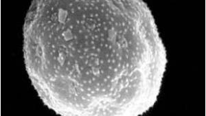 Imagen de grano de polen de Chenopodiacea/Amarantaceae (Cenicientos) al microscopio electrónico