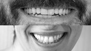 Sonrisas de pacientes de salud mental