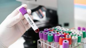 IMAGEN CORONAVIRUS