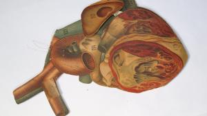 Lámina de Anatomía Humana antes de la restauración Láminas de Anatomía Humana restauradas