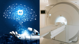Imagen referente a Inteligencia Artificial y un equipo de resonancia magnética