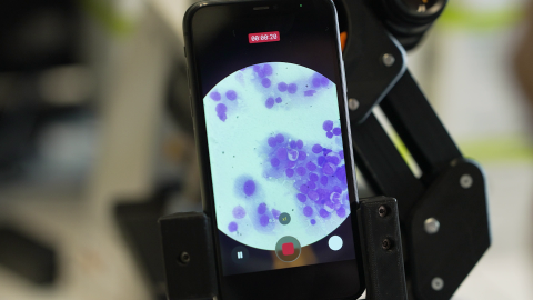 Vemos círculos azules y blancos a través de un microscopio