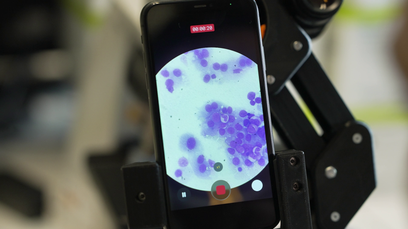 Vemos círculos azules y blancos a través de un microscopio