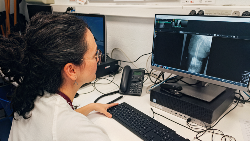 Imagen de un profesional del Hospital Universitario Ramón y Cajal examinando una radiografía de cadera
