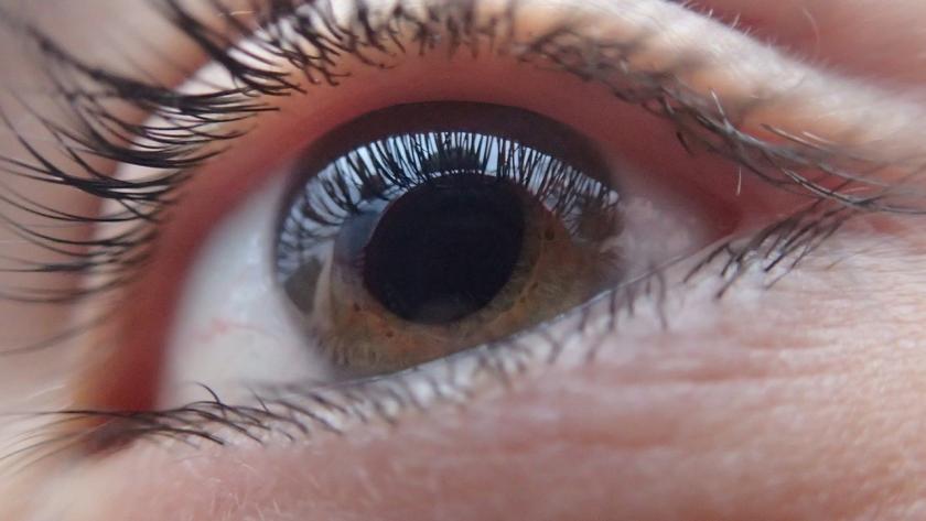 La cirugía de cataratas es un procedimiento quirúrgico muy habitual Imagen de un ojo