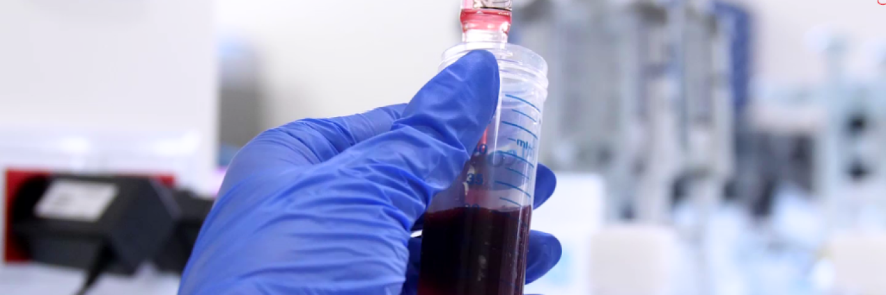 Mano con guante azul con una jeringa con líquido rojo y de fondo laboratorio