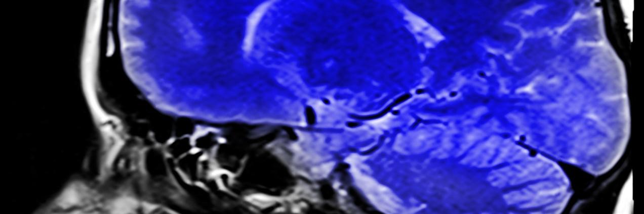 Corte tomográfico sagital del cerebro