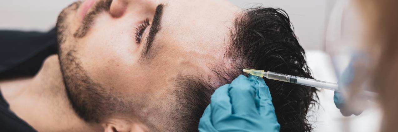 implante clinica capilar