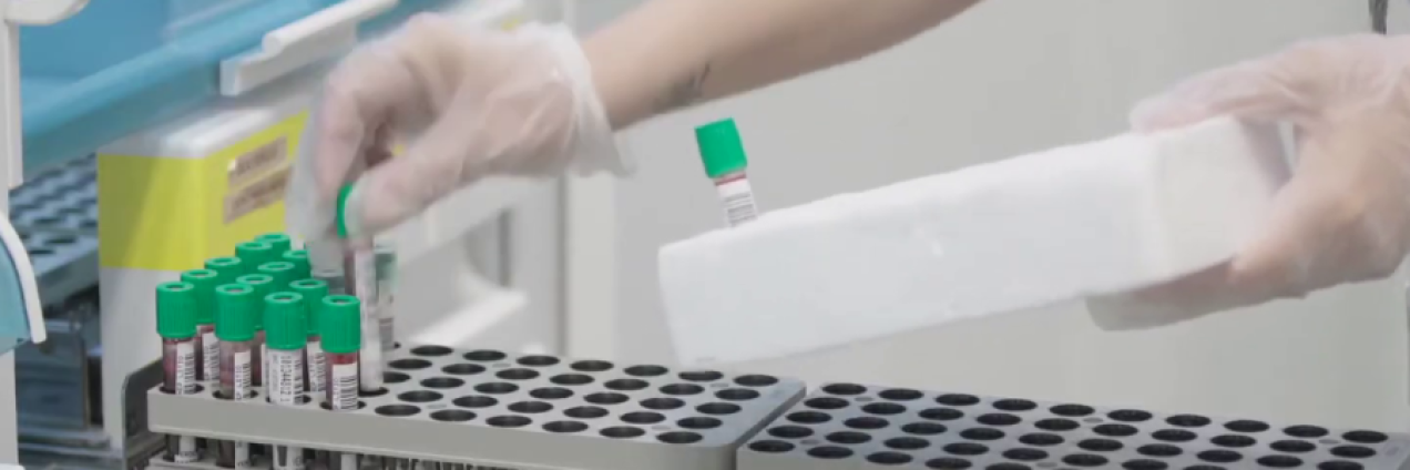 Laboratorio tubos de análisis y una mano que los coloca