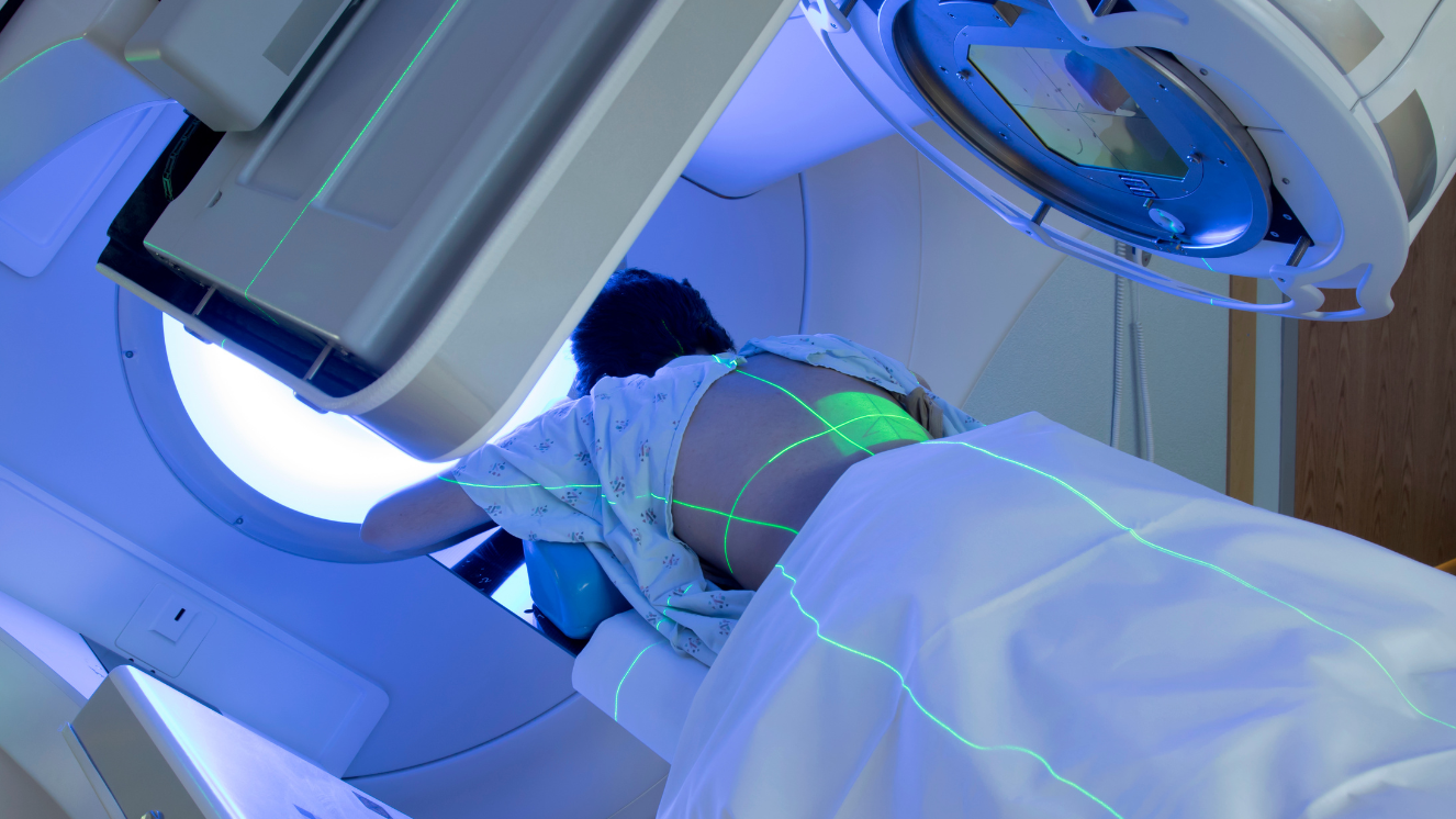 Paciente tumbado boca abajo mientras le aplican radioterapia en la espalda