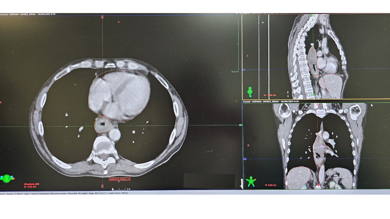 imágenes radiológicas de una cervix en pantalla