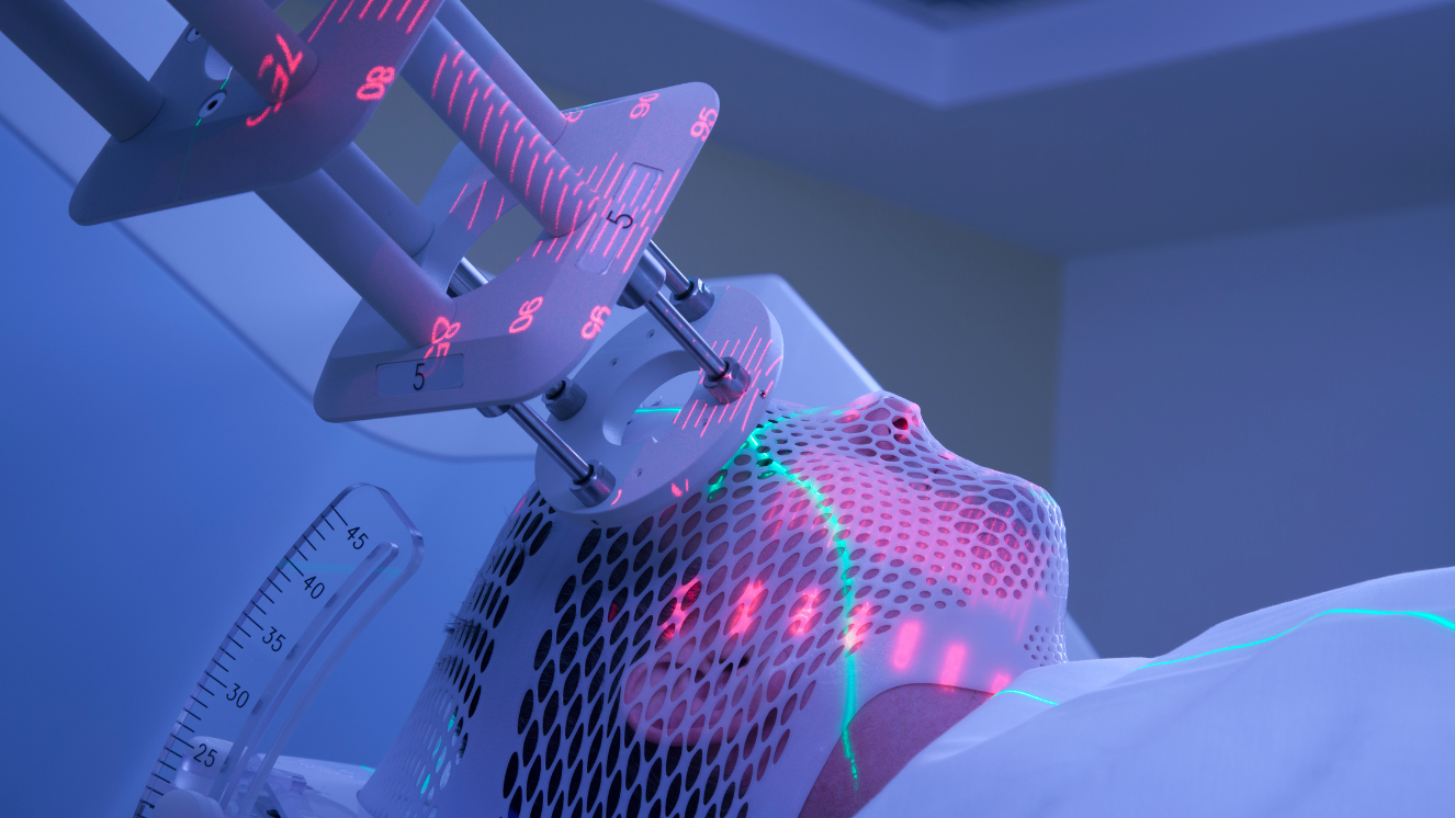 paciente tumbado mientras le aplican radioterapia en la cabeza