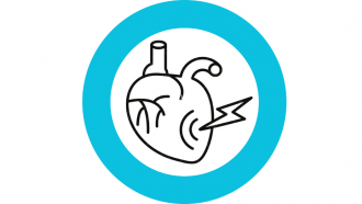 Infarto agudo de miocardio (prueba)
