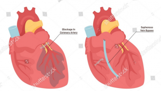 Ilustración del interior de dos corazones (prueba)