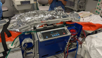 Máquina ECMO para paciente pediátrico