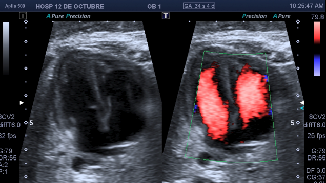 Ecocardiografía fetal