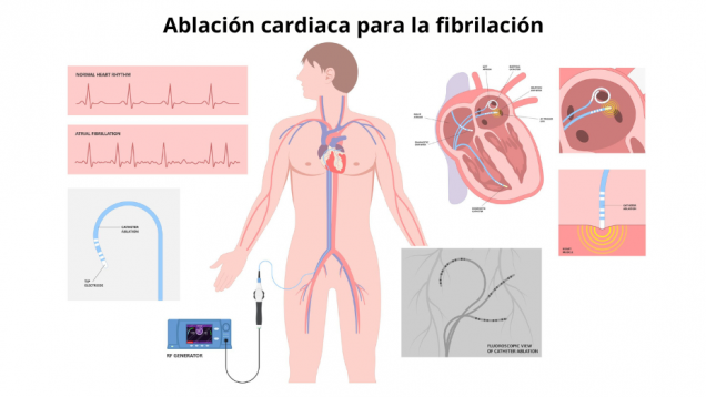 gráficos del ritmo cardiaco a la izquierda, imagen prediseñada de hombre con corazón y sistema circulatorio en el centro, a la izquierda corazón