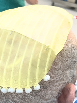 soporte amarillo con tubos o catéteres colocado en la cabeza