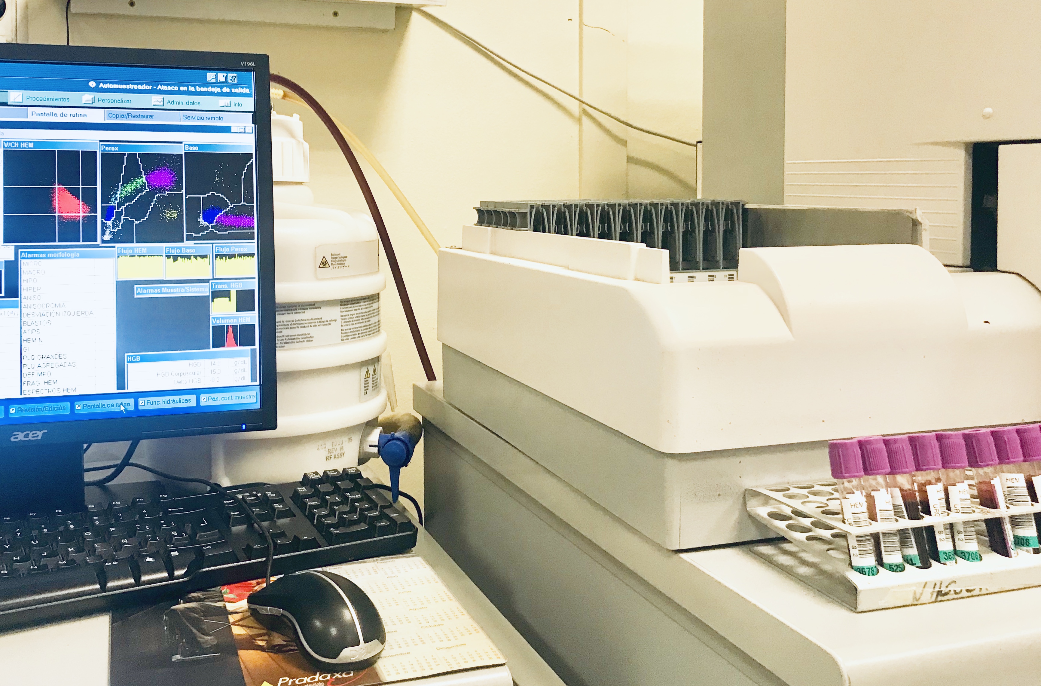 Hematología y Hemoterapia Hospital Universitario de Móstoles