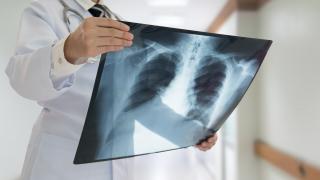 medico examinando una radiografía