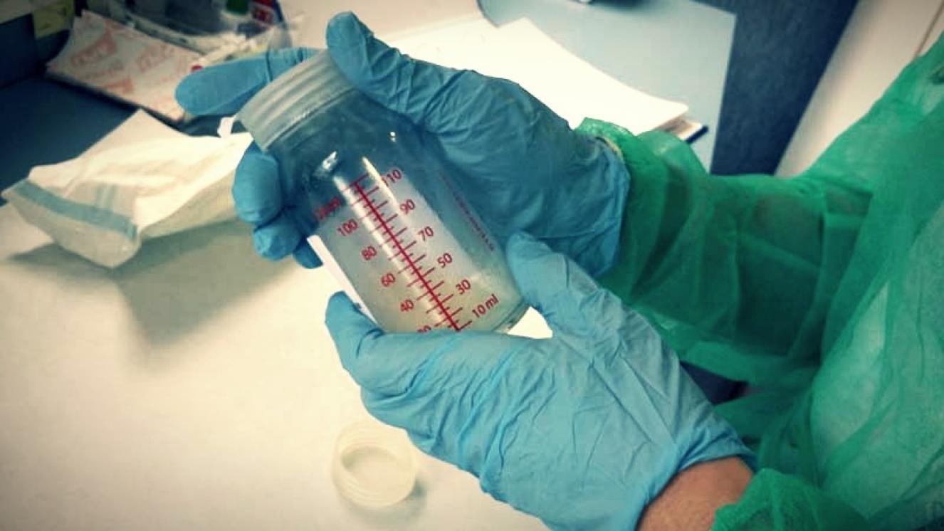 Hospital Severo Ochoa | Donación de Leche - Almacenamiento y Conservación