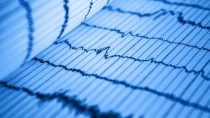 grafica electrocardiograma