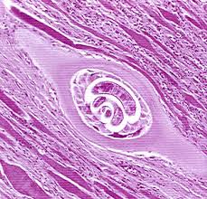 Trichinella corte histológico de músculo