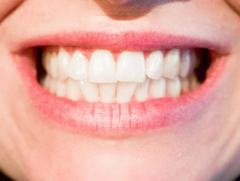 Dientes sanos