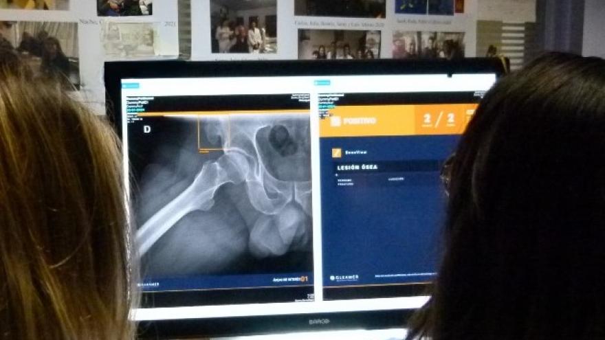 Aplicación Boneview
