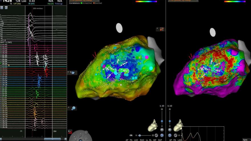IMAGEN TORMENTA VENTRICULAR 1