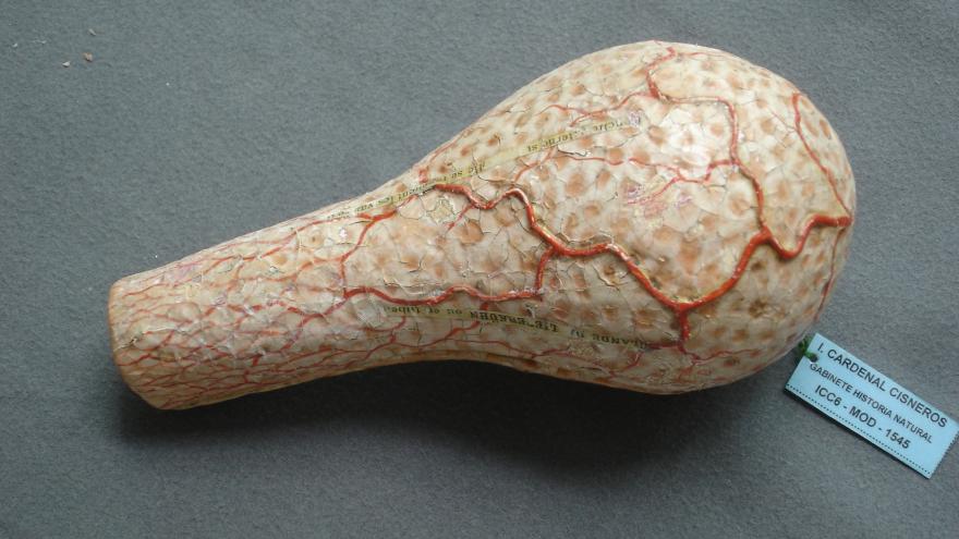 Glándula de Brunner