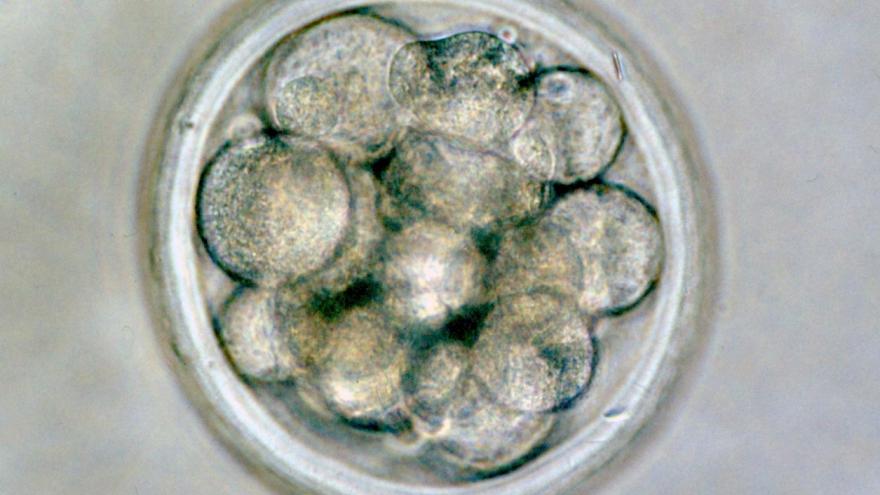 Embrión de ovino