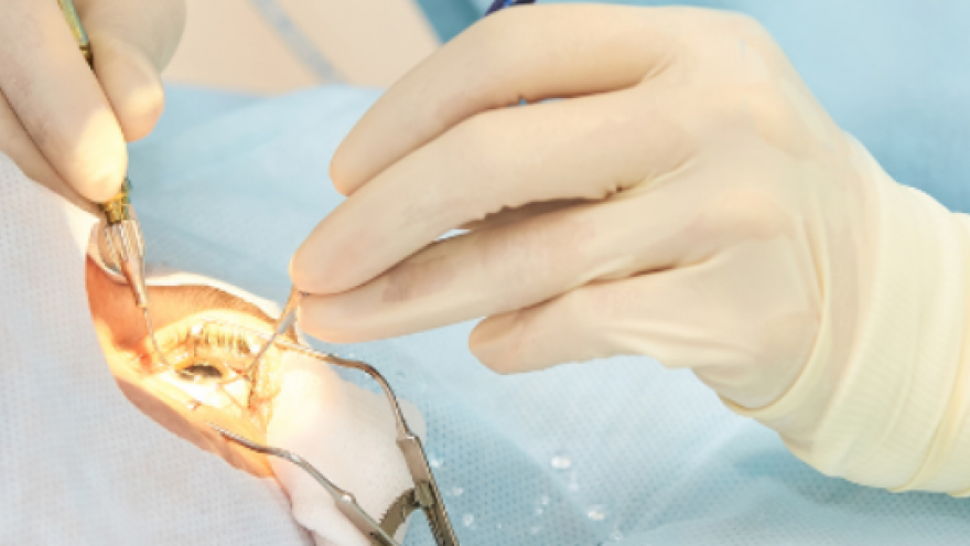 primer plano  de manos con guantes blancos interviniendo en un ojo en quirófano