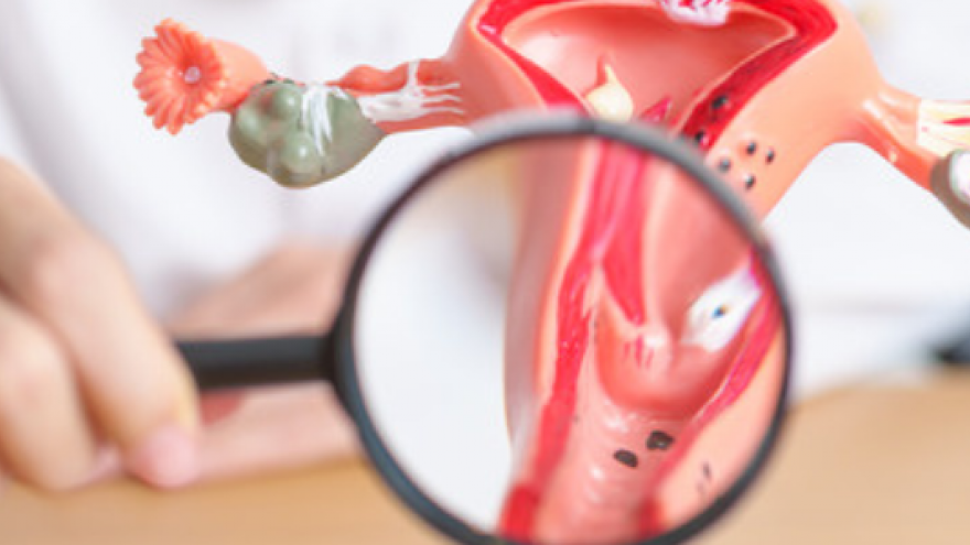 Aparato genital Lupa de médico observando un modelo de plástico de aparto genital