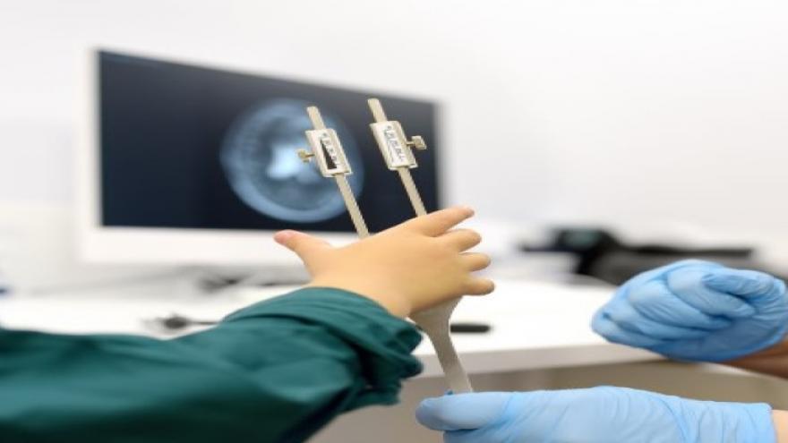 Foto: terapeuta ocupacional con un niño