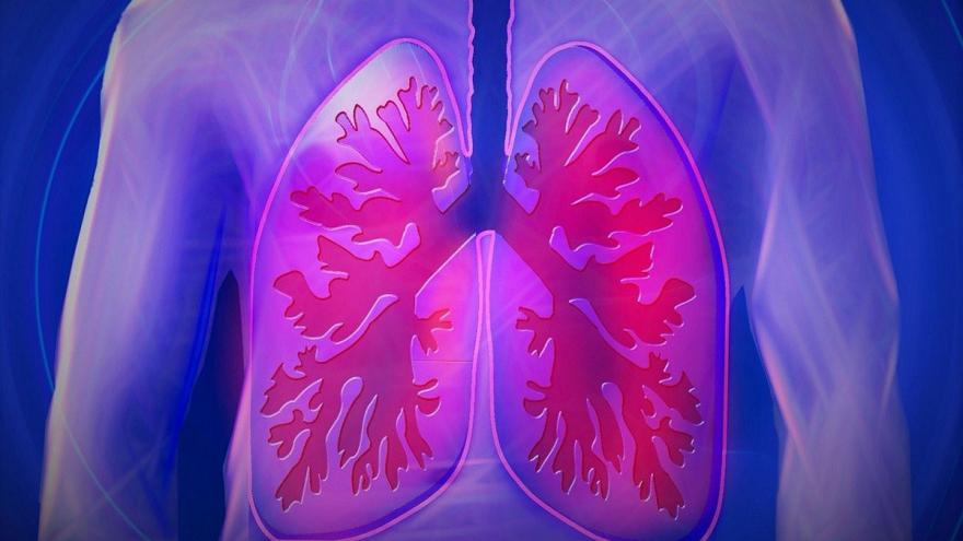 IMAGEN PULMONES.