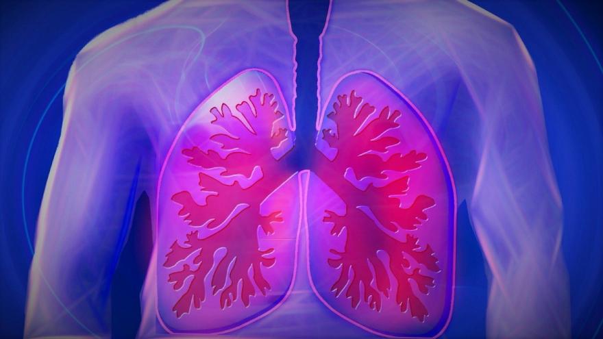 Imagen pulmones