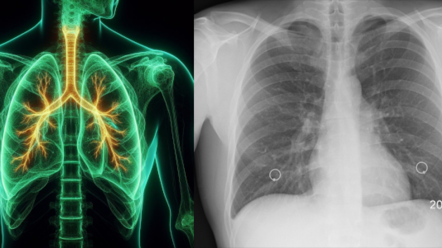 Imagen compuesta con radiografía de pulmón, profesionales sanitarios y ambulancias