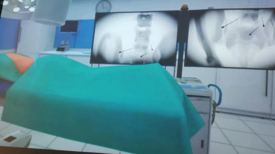 Técnica de tratamiento del dolor con radiofrecuencia