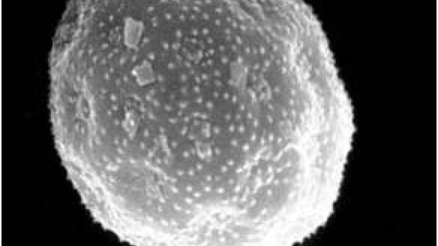 Polen de Chenopodiacea/Amarantaceae (Cenicientos) Imagen de grano de polen de Chenopodiacea/Amarantaceae (Cenicientos) al microscopio electrónico