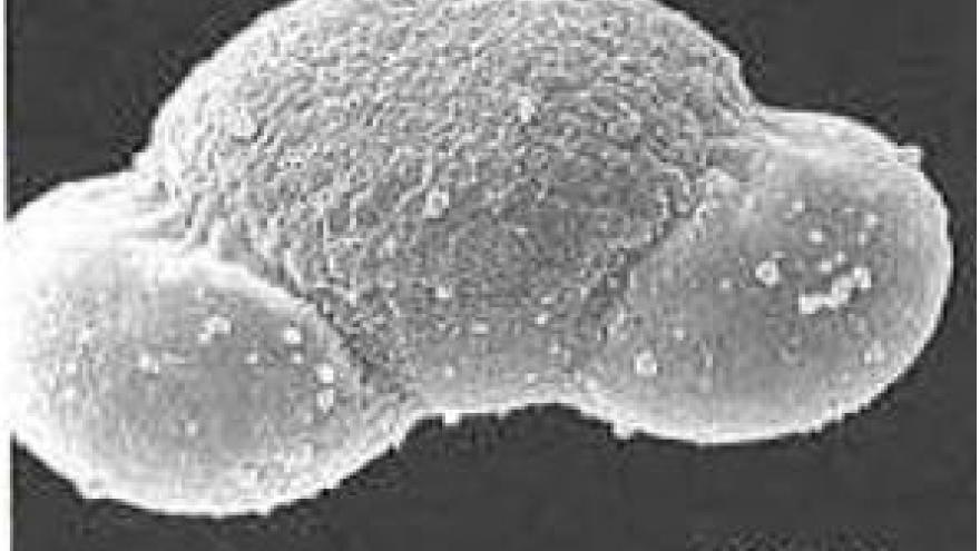 Imagen de grano de polen de Pinus (pino) al microscopio electrónico