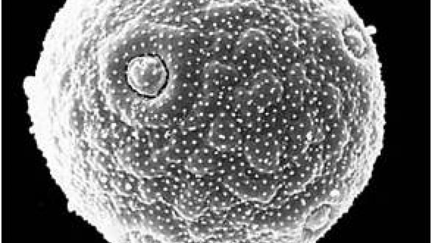 Polen de plantago Imagen de grano de polen de Plantago al microscopio electrónico