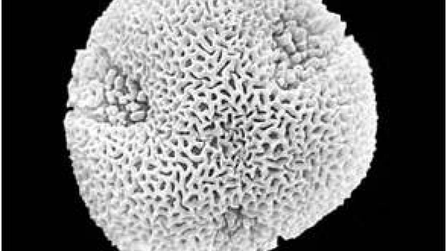 Polen de Platanus Imagen de un grano de polen de Platanus al microscopio electrónico