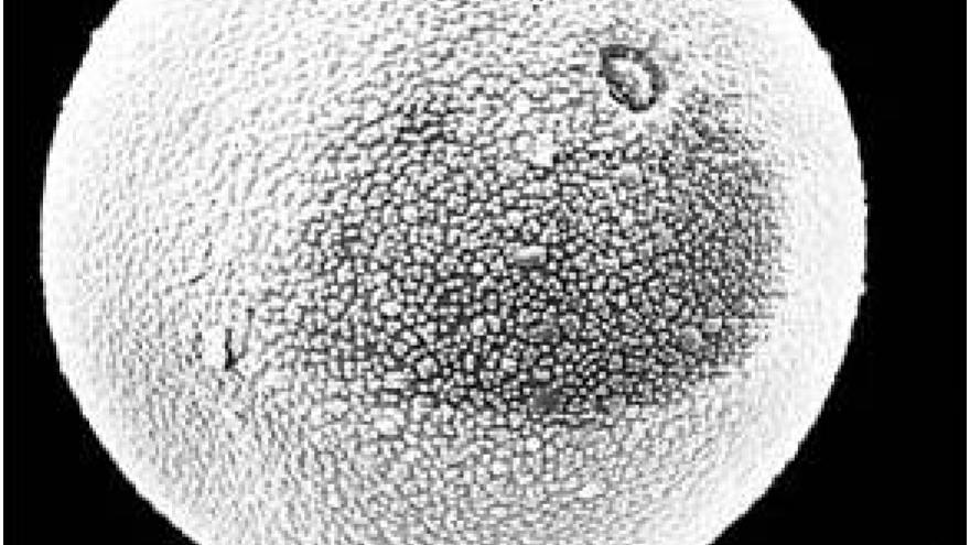 Polen de Poaceae (gramíneas) Imagen de grano de polen de Poaceae