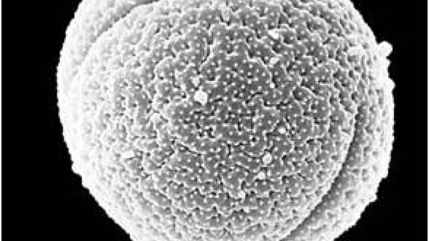 Imagen de grano de polen de Rumex (acedera) al microscopio electrónico