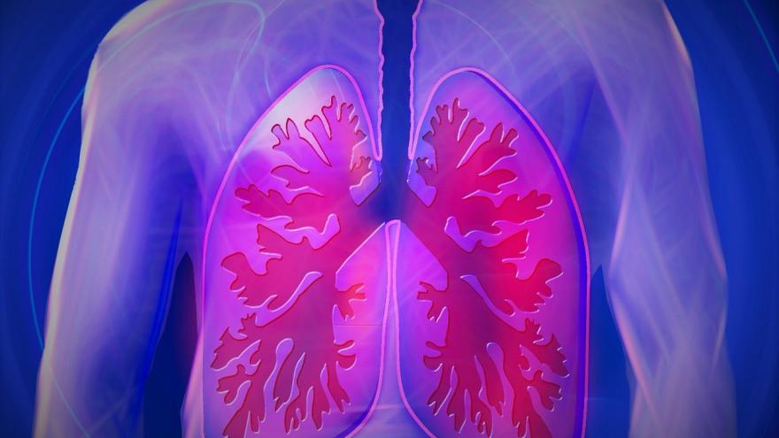 Esquema de los pulmones
