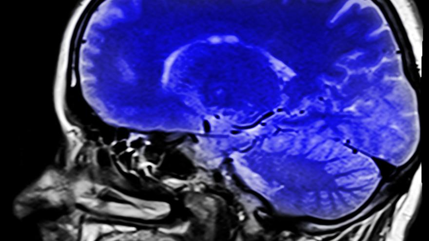 Corte tomográfico sagital del cerebro