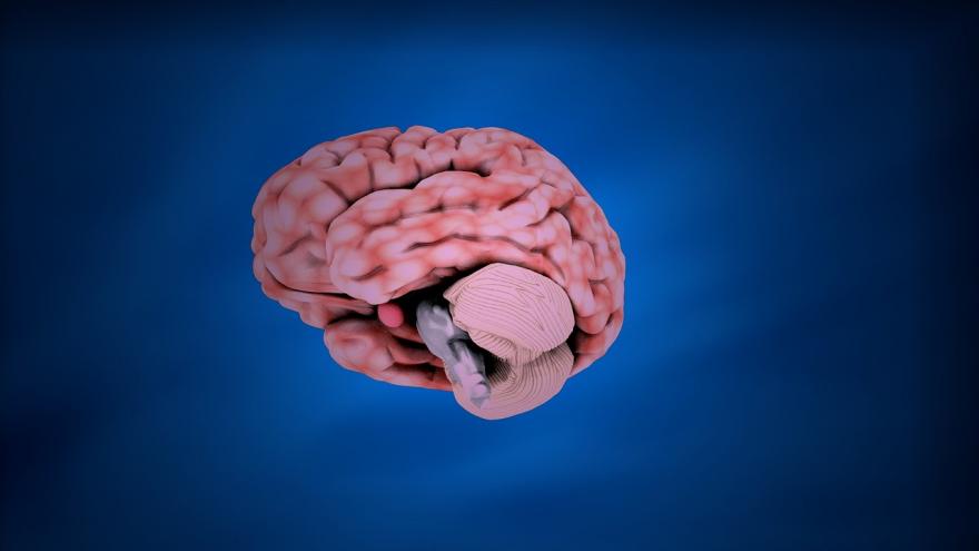 FE en Neurología Infografía de un cerebro