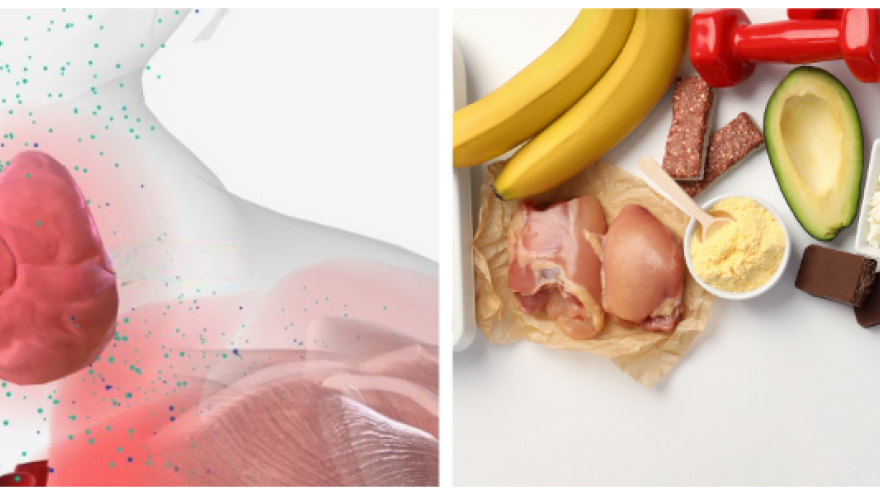 Imagen de glándula tiroidea y bocio y otra imagen de alimentos