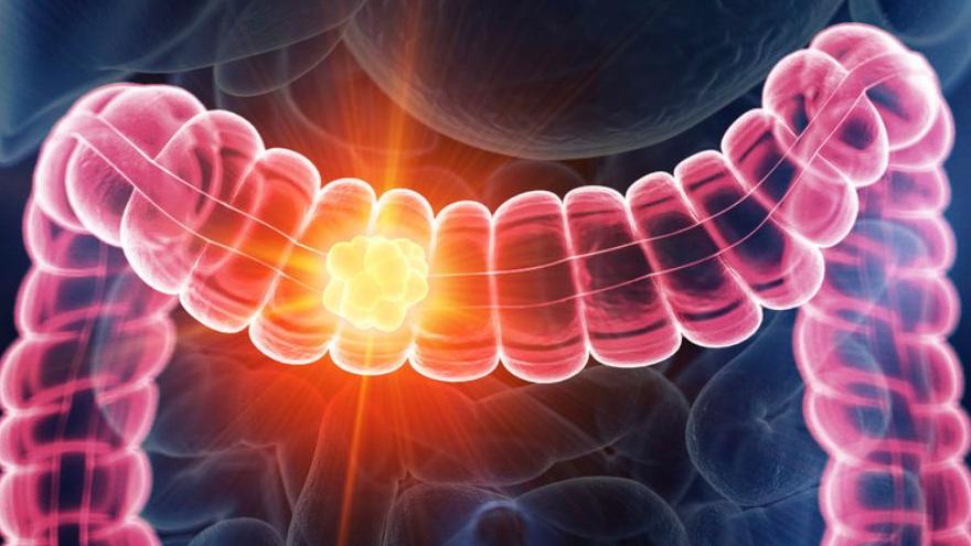 Imagen en 3D de colon